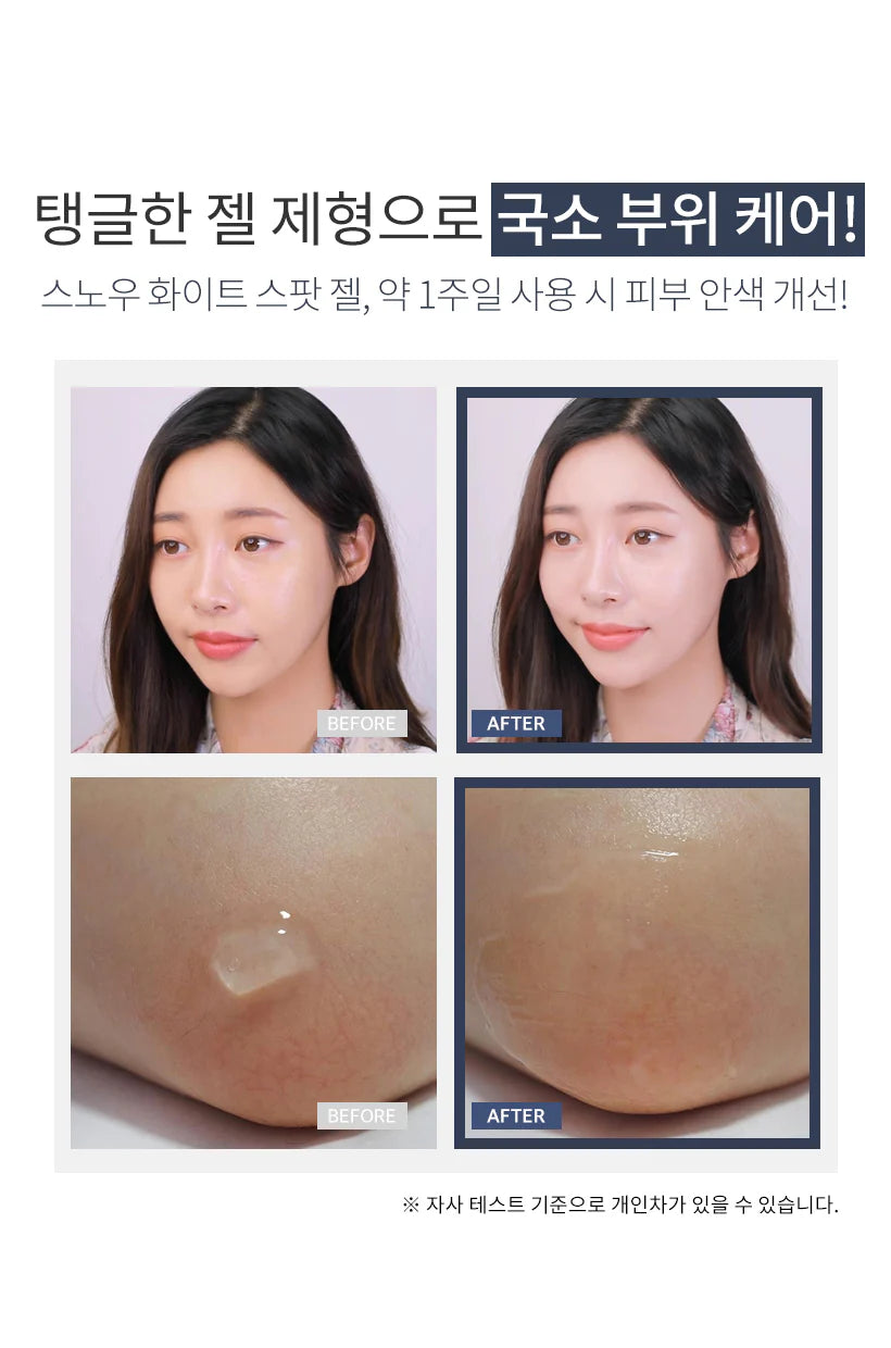 SECRET KEY SNOW WHITE SPOT GEL