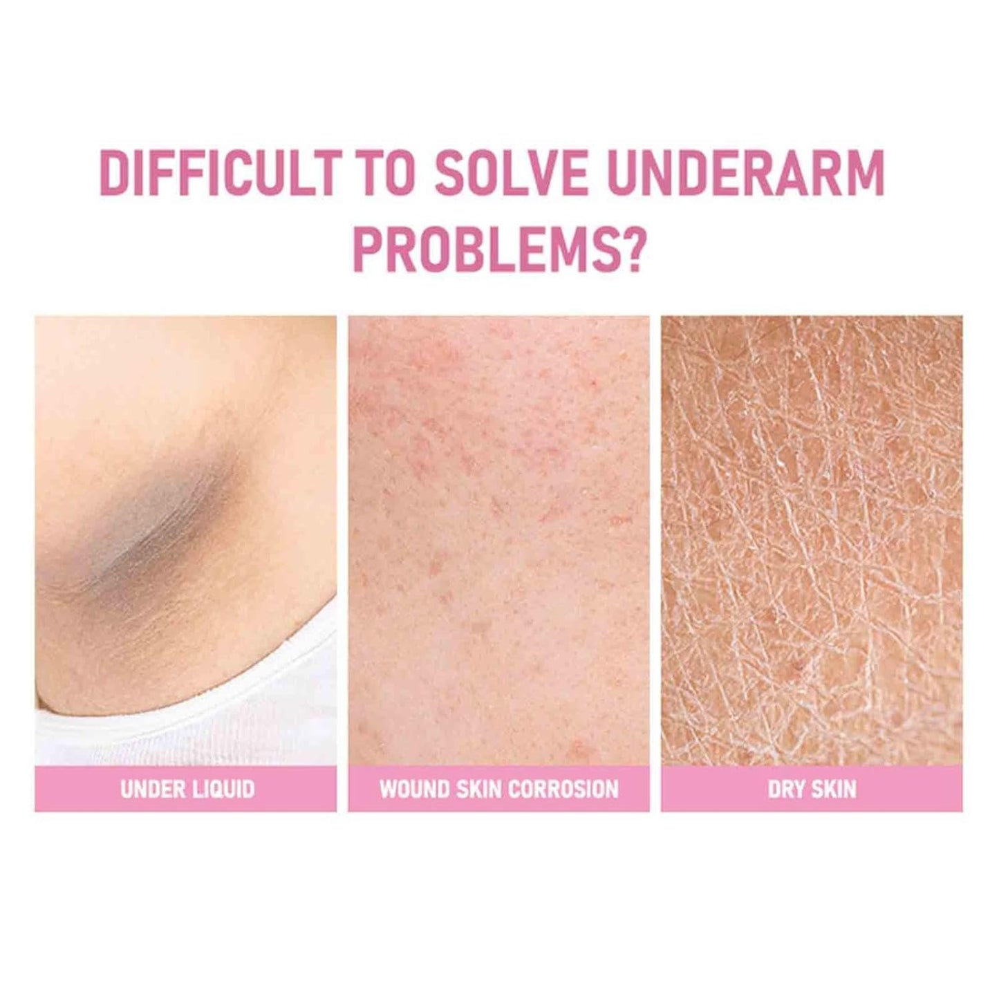 Sakura Gluta Underarm Whitening Cream,Intimate Area Skin Lightening Cream