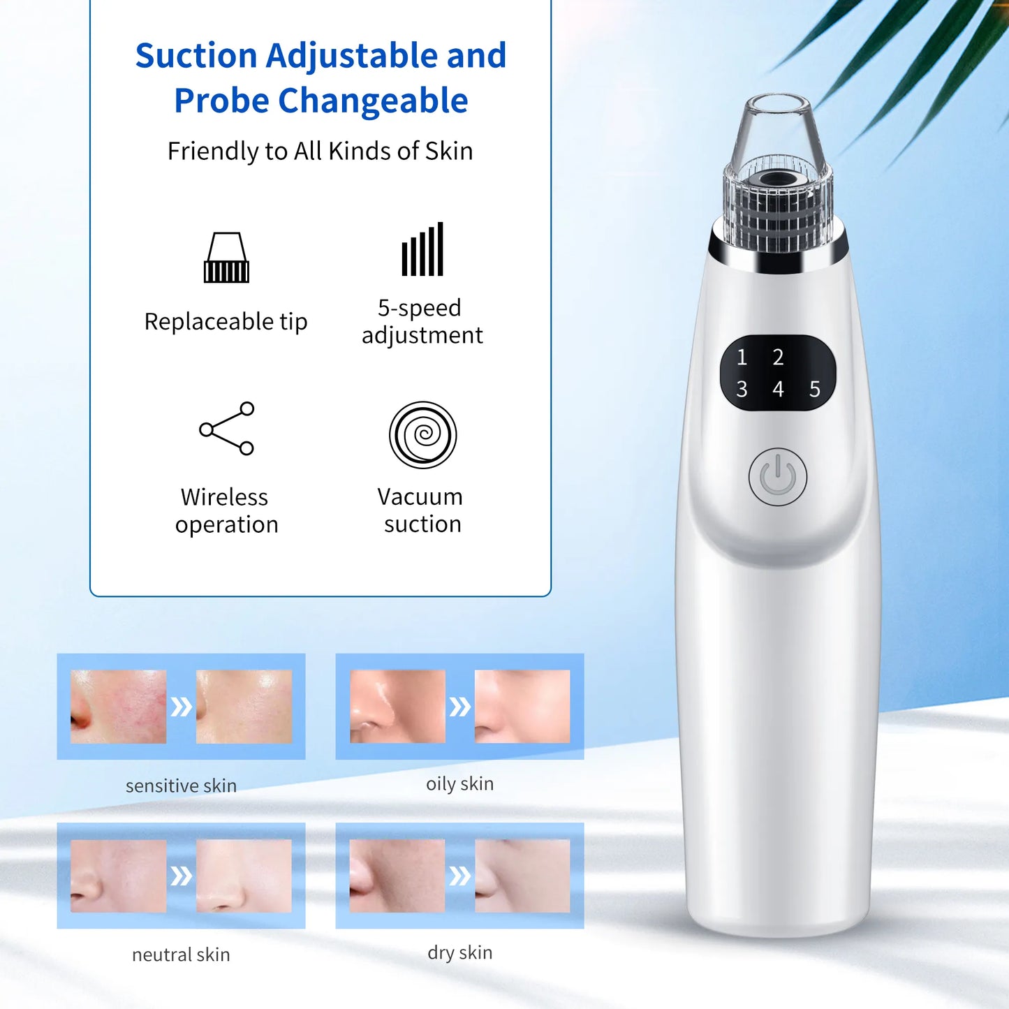 Pore Cleaner Black Head Acne Treatment Suction Extractor Facial and Whitehead Head Electronic Blackhead Remover Vacuum