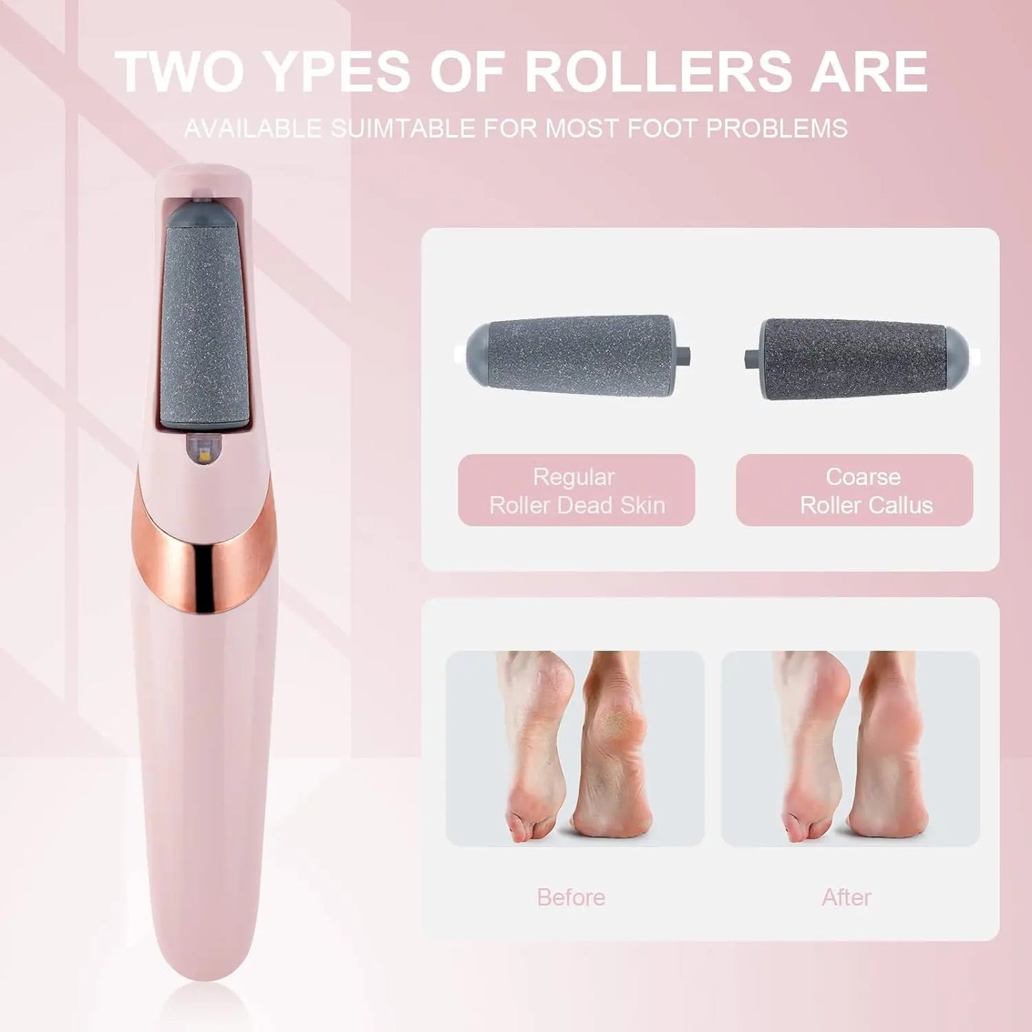 Electric Foot Callus Remover Foot File Electric Callus Remover for Feet Callous Remover Tool Kit for Feet