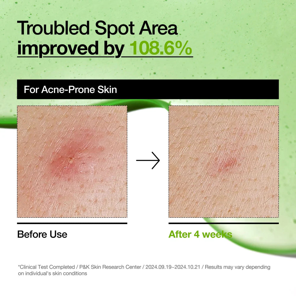 Azelaic Acid 10 Hyaluron Redness Soothing Serum ANUA