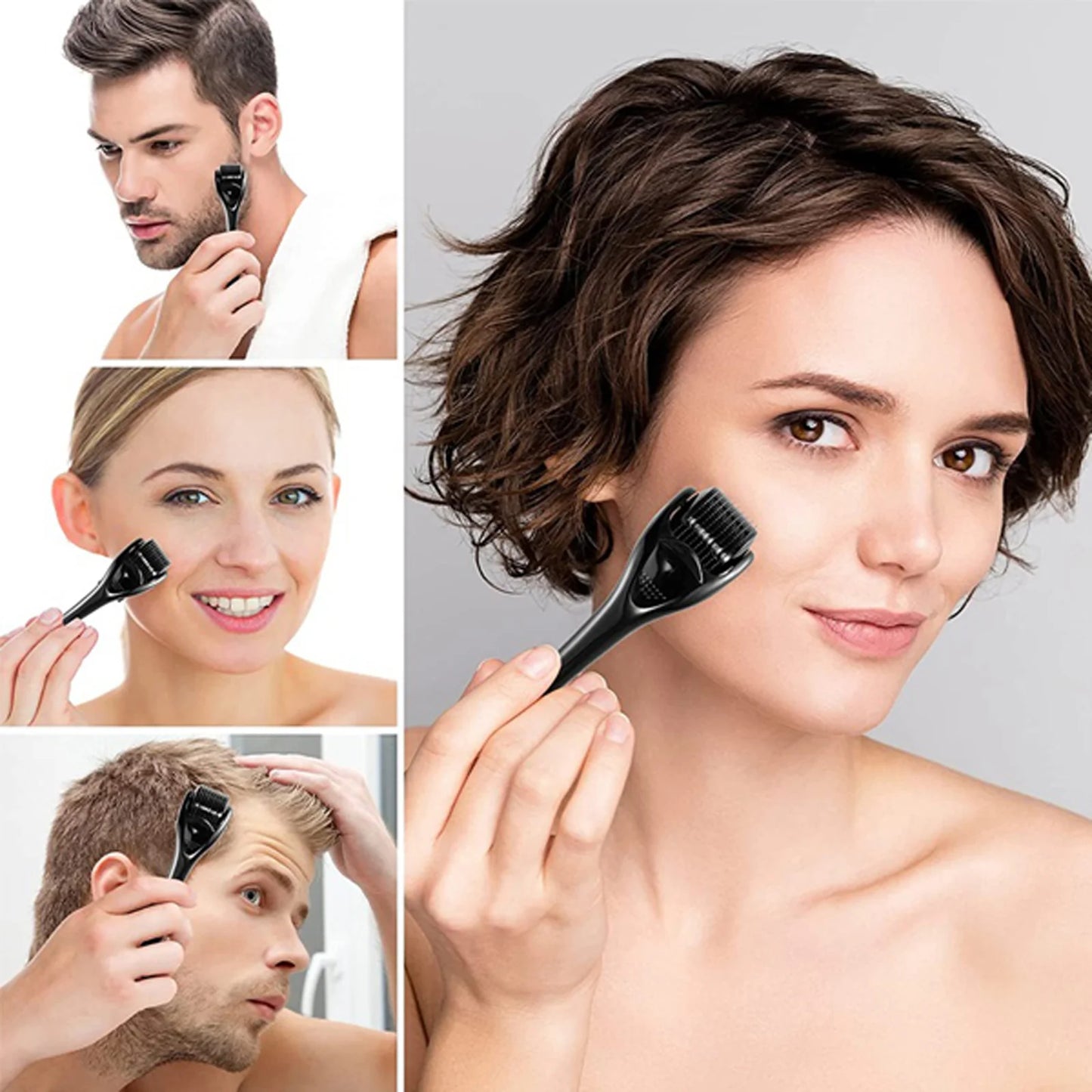 Hyper Derma Roller 540 Needles For Face And Head 0.3mm