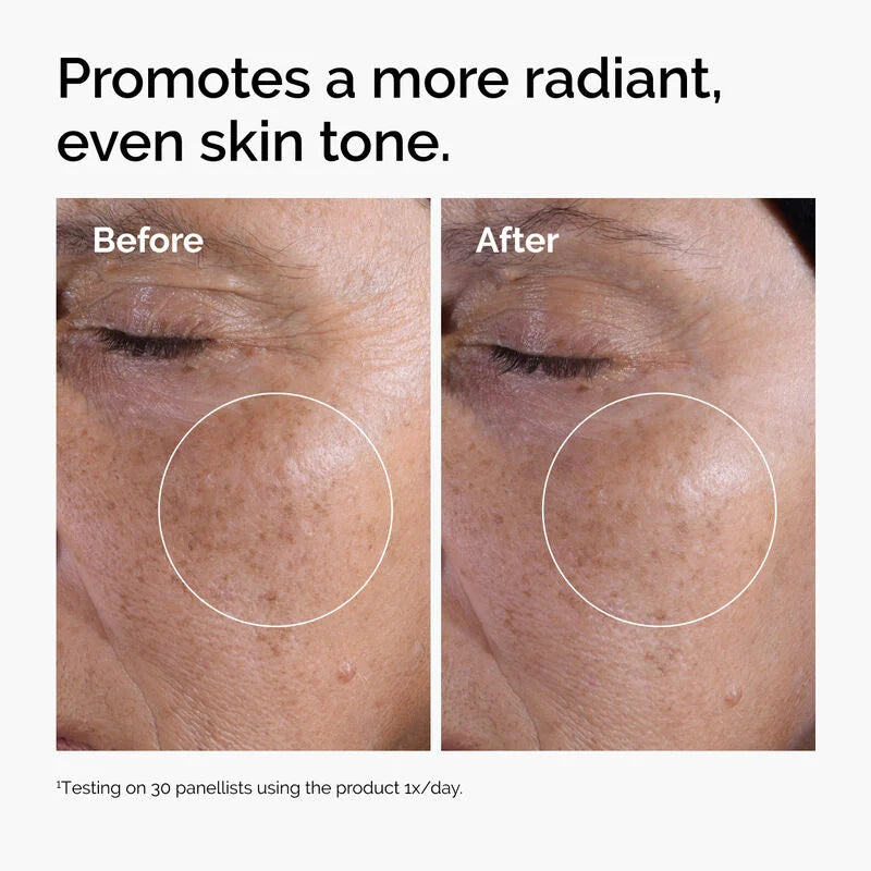 The Glycolic Acid Set - The Ordinary
