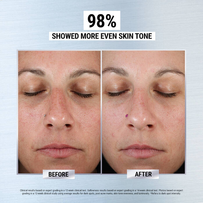 Clearly Corrective Dark Spot Corrector | kiehl's--Eclatbody-kiehls-