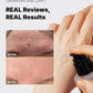 COSRX Advanced Snail 96 Mucin Power Essence-skin care-Eclatbody-COSRX-