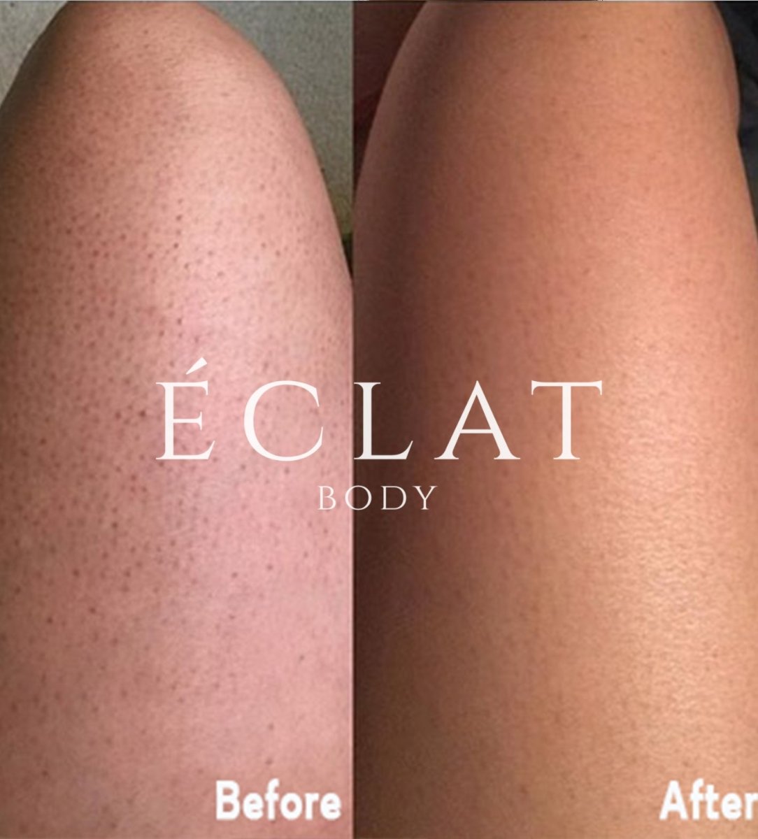 best Exfoliating Glove for body 100% natural and healthy for exfoliating the skin by eclat body lab