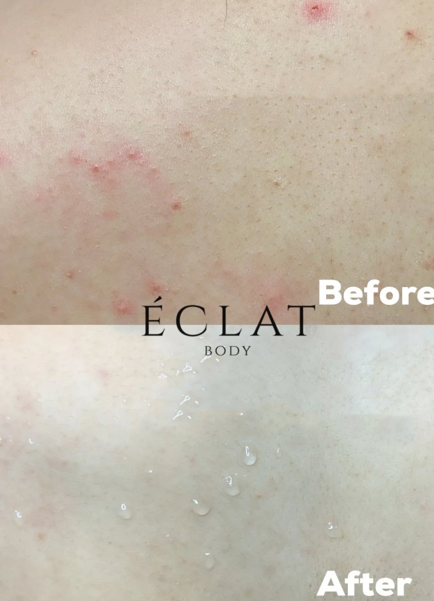 best Exfoliating Glove for body 100% natural and healthy for exfoliating the skin by eclat body lab