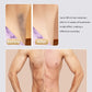 IPL Max Laser | Epilator Device for Women & Men | Facial, Armpits, Bikini Line, Legs and Arms-Health & Beauty-Eclatbody-Eclat-