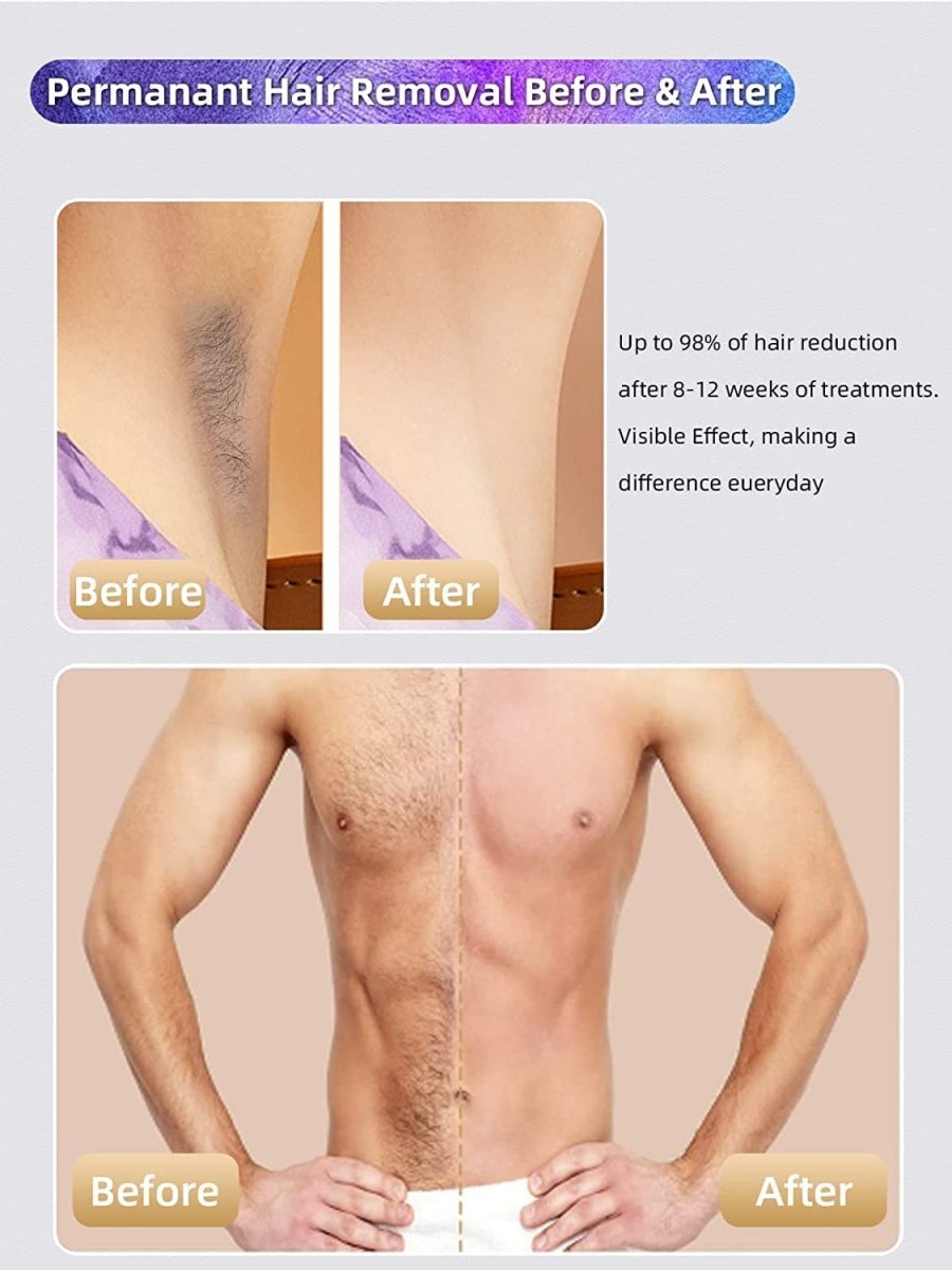 IPL Max Laser | Epilator Device for Women & Men | Facial, Armpits, Bikini Line, Legs and Arms-Health & Beauty-Eclatbody-Eclat-