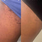 High Roller Ingrown Tonic With AHAs + BHAs