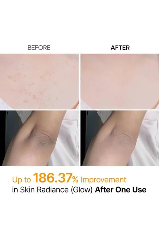 Peel Shot Exfoliating Kojic Acid Turmeric Spray Serum
