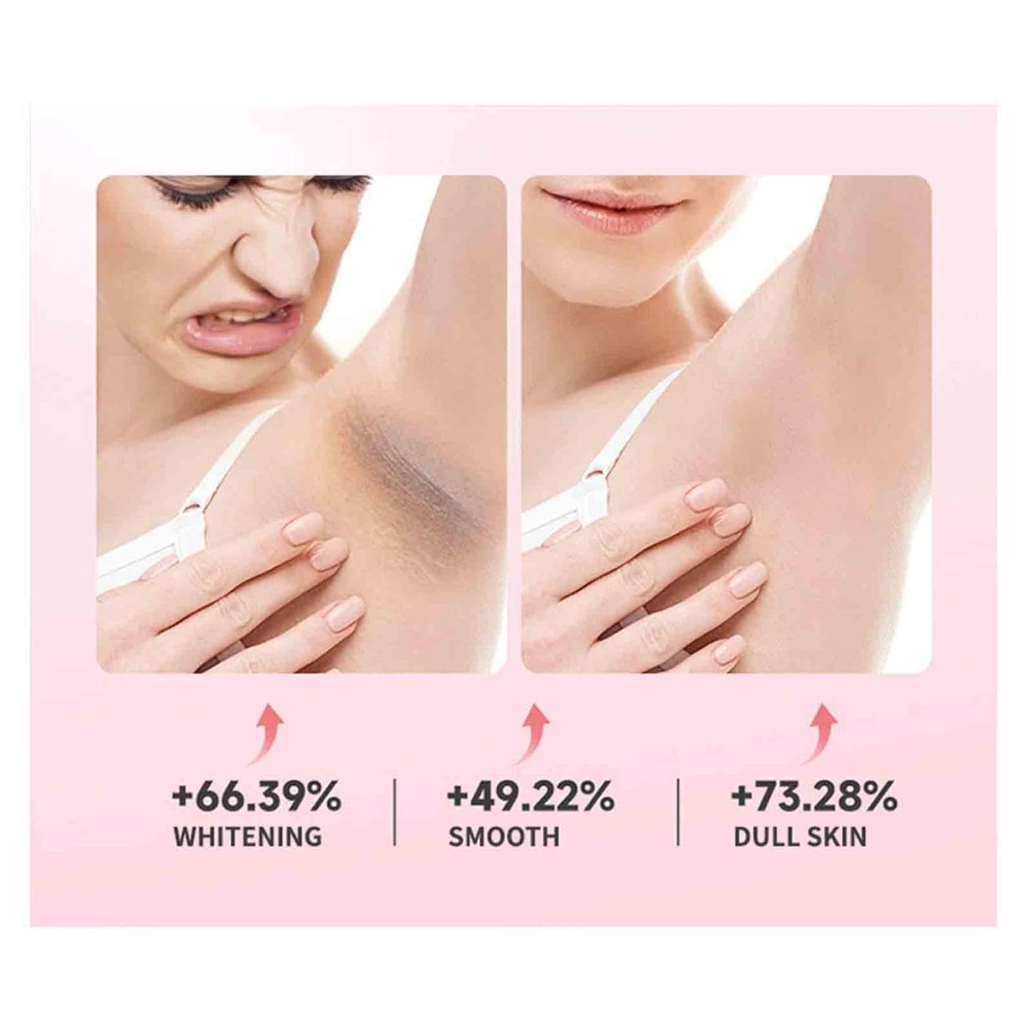 Sakura Gluta Underarm Whitening Cream,Intimate Area Skin Lightening Cream