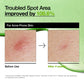 Azelaic Acid 10 Hyaluron Redness Soothing Serum ANUA