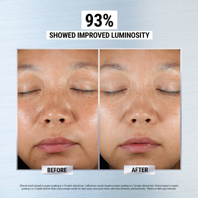 Clearly Corrective Dark Spot Corrector | kiehl's--Eclatbody-kiehls-