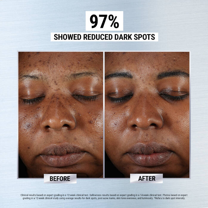 Clearly Corrective Dark Spot Corrector | kiehl's--Eclatbody-kiehls-
